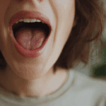 Rintasyöpähoidot voivat kuivattaa suuta ja aiheuttaa suun limakalvoille kiusallisen tulehduksen.