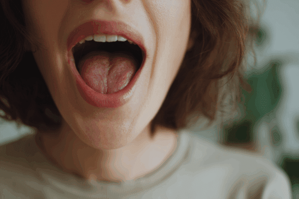 Rintasyöpähoidot voivat kuivattaa suuta ja aiheuttaa suun limakalvoille kiusallisen tulehduksen.