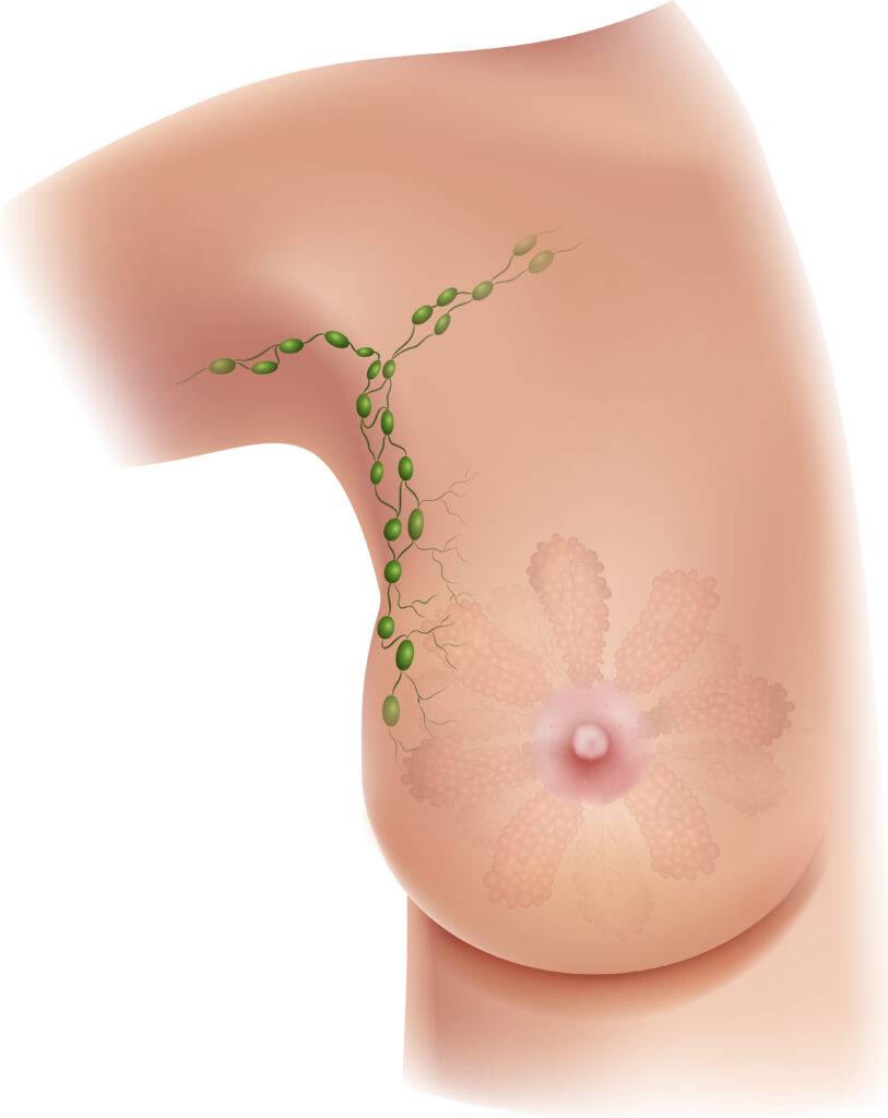 Piirros, rintarauhanen ja kainalon imusolmukkeet